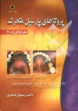 پروتزهای پارسیل متحرک (مک کراکن) 2005