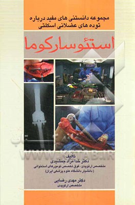 مجموعه دانستنی‌های مفید درباره توده‌های عضلانی اسکلتی: راهنمای شماره 1: استئوسارکوما