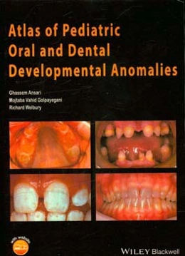 Atlas of pediatric oral and dental developmental anomalies