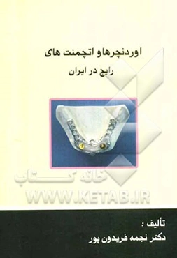 اوردنچرها و اتچمنت‌های رایج در ایران