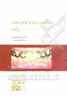 تشخیص بیماریهای دهان: برکت