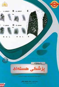 رادیولوژی: پزشکی هسته‌ای: مجموعه سوالات آزمون ارتقاء و بورد رادیولوژی با پاسخ تشریحی ...
