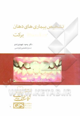 تشخیص بیماریهای دهان: برکت
