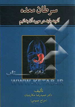 سرطان معده "آنچه باید در مورد آن بدانیم"