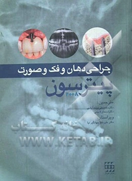 جراحی دهان، فک و صورت پیترسون 2008 (به انضمام اصول فارماکولوژیک و مراقبت‌های لازم قبل از عمل از درسنامه جراحی فک و صورت)