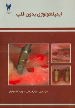 ایمپلنتولوژی بدون فلپ