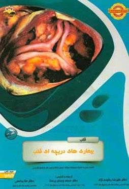 قلب: بیماری‌های دریچه‌ای قلب: مجموعه سوالات آزمون ارتقاء و بورد قلب با پاسخ تشریحی ...