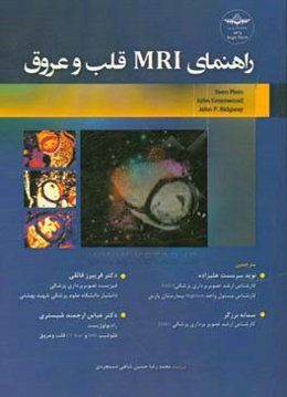 راهنمای MRI قلب و عروق