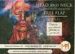 head and neck reconstruction with free flap