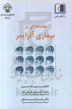 مقدمه‌ای بر بیماری آلزایمر