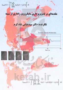 مقدمه‌ای بر تصویربرداری مایکروویو راداری از سینه