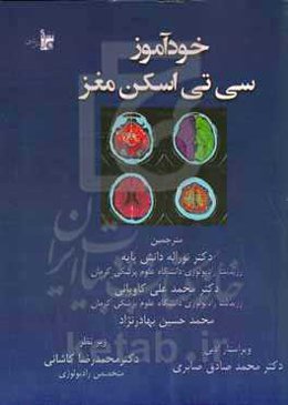 خودآموز سی‌ تی اسکن مغز