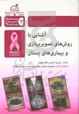 آشنایی با روش‌های تصویربرداری و بیماری‌های پستان