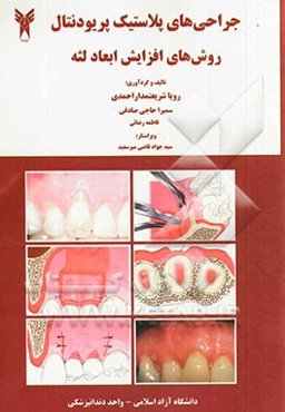 جراحیهای پلاستیک پریودنتال: روشهای افزایش ابعاد لثه