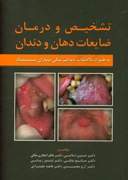 تشخیص و درمان ضایعات دهان و دندان به همراه ملاحظات دندان‌پزشکی بیماران سیستمیک