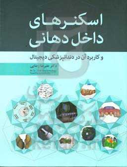 اسکنرهای داخل دهانی و کاربرد آن در دندانپزشکی دیجیتال
