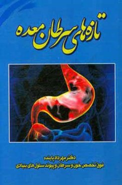 تازه‌های سرطان معده