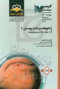 پوست: نئوپلاسم‌های پوستی‏‫ (1): خلاصه درس به همراه مجموعه سوالات آزمون ارتقاء و بورد پوست با پاسخ تشریحی ...