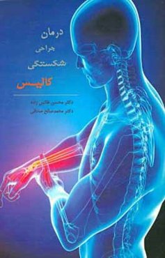 درمان جراحی شکستگی کالیس