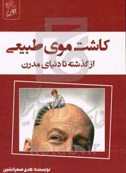 کاشت موی طبیعی از گذشته تا دنیای مدرن