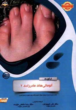 ارتوپدی: آنومالی‌های مادرزادی 2: خلاصه درس به همراه مجموعه سوالات آزمون ارتقاء و بورد ارتوپدی با پاسخ تشریحی Campbell 2013, Tachdjian 2014