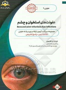 عفونی: عفونت‌های استخوان و چشم: خلاصه درس به همراه مجموعه سوالات آزمون ارتقاء و بورد عفونی با پاسخ تشریحی