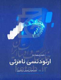 ارتودنسی نامرئی