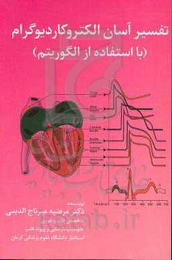 تفسیر آسان الکتروکادیوگرام با استفاده از الگوریتم