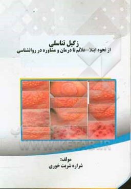 زگیل تناسلی: از نحوه ابتلا - علائم تا درمان و مشاوره در روانشناسی