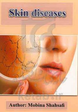 Skin diseases