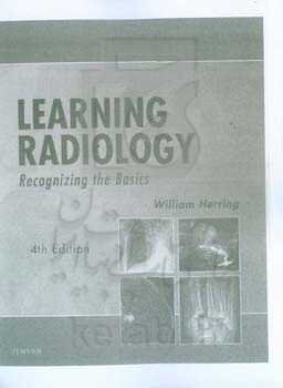 Learning radiology: recognizing the basics