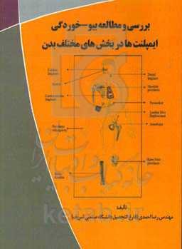 بررسی و مطالعه بیو - خوردگی ایمپلنت‌ها در بخش‌های مختلف بدن