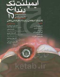 ایمپلنت تک‌دندانی رویکرد کم‌تهاجم برای ساکت‌های قدامی و خلفی