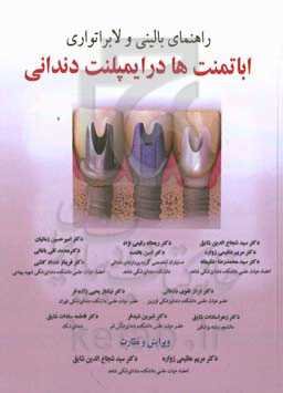 راهنمای بالینی و لابراتواری اباتمنت‌ها در ایمپلنت‌های دندانی