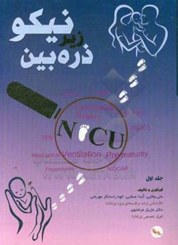 نیکو NICU زیر ذره‌بین