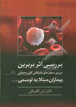 بررسی اثر بربرین بر روی سلول‌های سرطانی خون محیطی بیماران مبتلا به لوسمی لنفوئیدی مزمن در In vitro