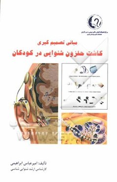 مبانی تصمیم‌گیری کاشت حلزون شنوایی در کودکان