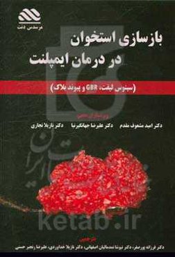 بازسازی استخوان در درمان‌های ایمپلنت