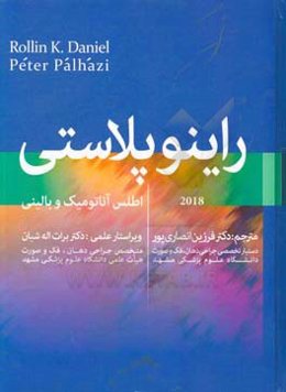 راینوپلاستی 2018