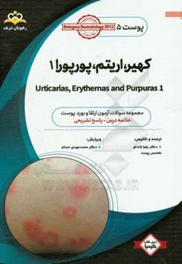 پوست: کهیر، اریتم، پورپورا 1: خلاصه درس به همراه مجموعه سوالات آزمون ارتقا و بورد پوست با پاسخ تشریحی