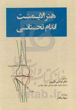 هنر الایمنت اندام تحتانی