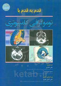 قدم به قدم با توموگرافی کامپیوتری