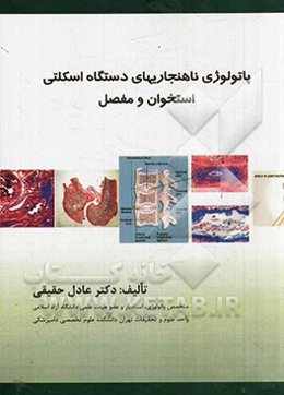 پاتولوژی ناهنجاری‌های دستگاه اسکلتی استخوان و مفاصل