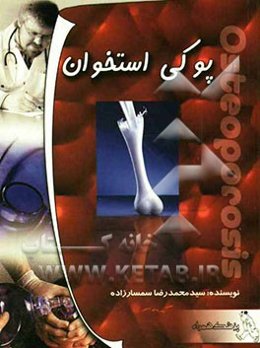 پوکی استخوان