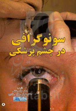 سونوگرافی در چشم‌پزشکی